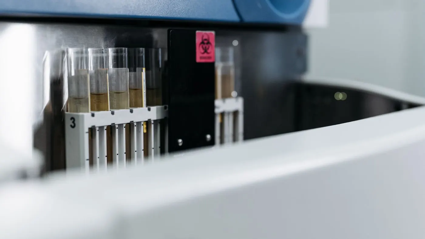 Tubos con muestras en la gradilla de un equipo de análisis de laboratorio, con una etiqueta de riesgo biológico: imagen para la guía del colesterol LDL
