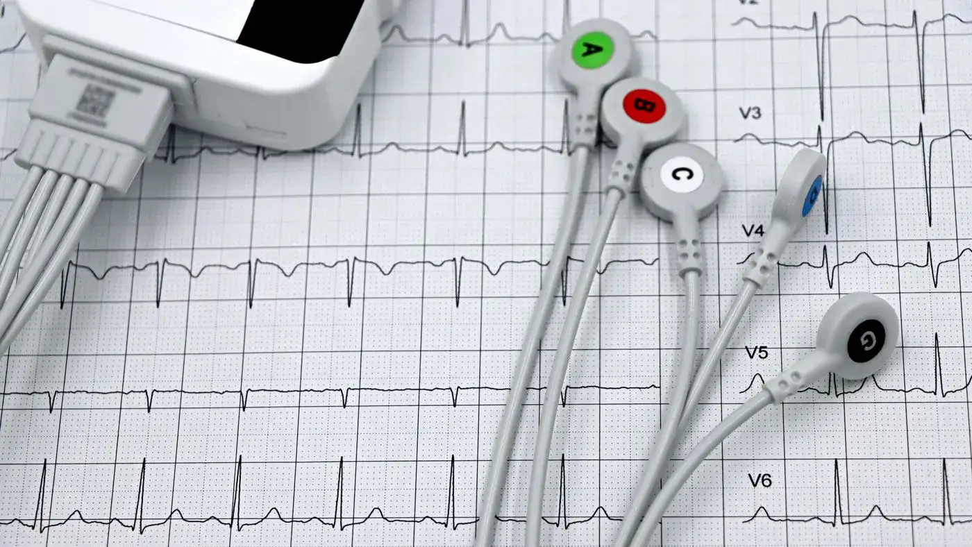 Cables con electrodos de broche y una grabadora blanca sobre un trazado de electrocardiograma impreso: imagen para la guía del Holter